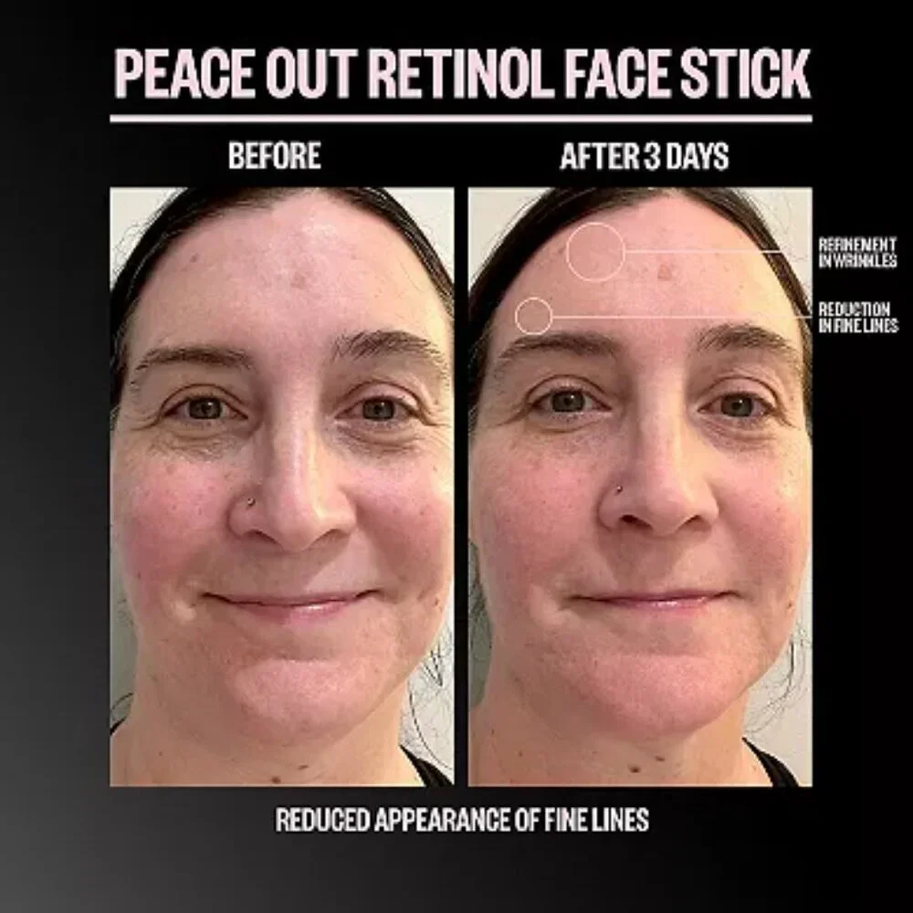 Peace Out Retinol Face Stick - NIB